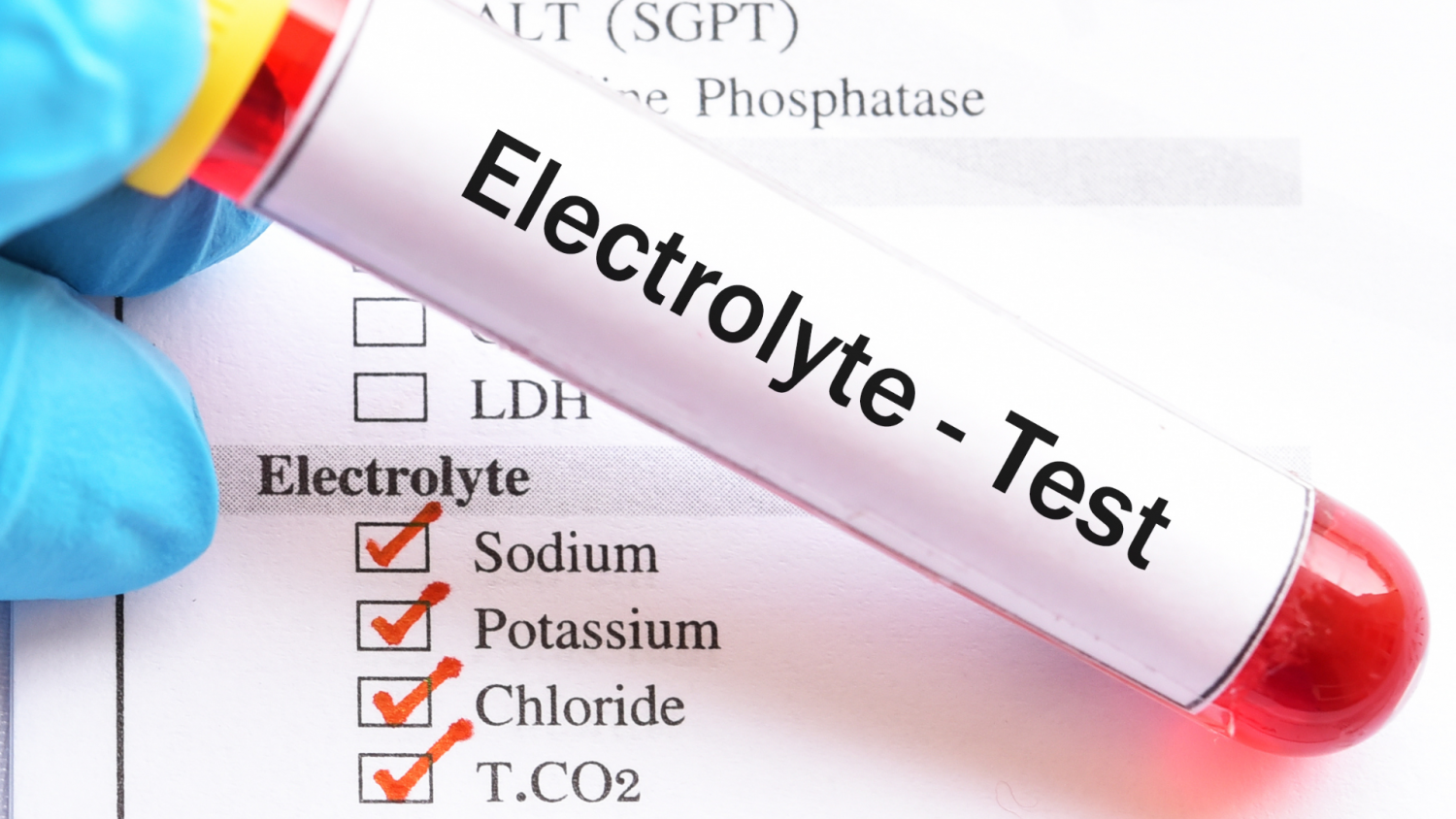 Why Runners Need Electrolytes During Long Runs - ArenaMalaysia.Asia